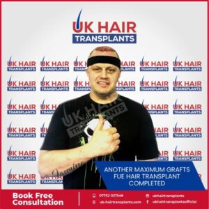 A person gives a thumbs up, wearing a black headband post-hair transplant. The "UK Hair Transplants" logo repeats in the background, highlighting triumph over hair loss. A banner reads, "Another Maximum Grafts FUE Hair Transplant Completed." Contact info included, underscoring our commitment even amid COVID-19 challenges.