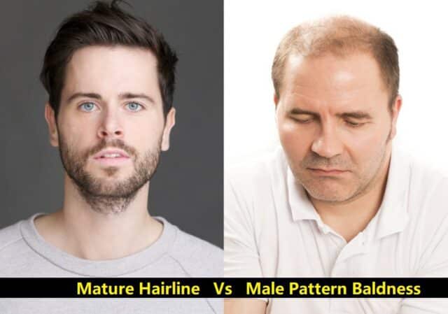 Comparison image of two men. The man on the left showcases a mature hairline, dark hair, and a beard. In contrast, the man on the right visibly displays male pattern baldness with a receding hairline and thinning strands. Text at the bottom reads "Mature Hairline Vs Male Pattern Baldness.