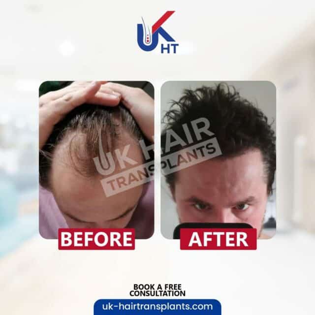 UKHT before after13.jpg