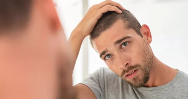 young hair loss